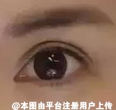 双眼皮设计宽度 很大程度上是受到眼部基础的影响