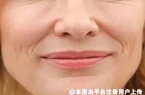 定格青春留住美丽 从抗衰开始-25432