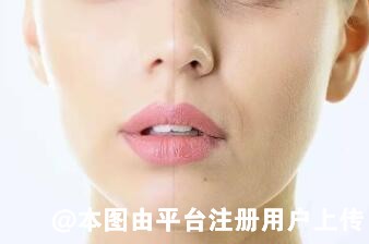 抗氧化和抗糖化我该选哪个 完全不吃糖不等于抗糖化