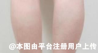 想要腿部吸脂后更快更好的恢复 做好腿部吸脂术后护理很关键