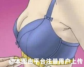 乳房下垂可选乳房上提矫正 实现胸部提升