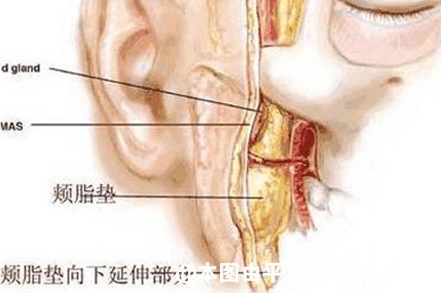 脸上肉太多显胖 是吸脂好还是去颊脂垫好