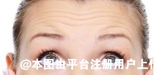 怎么样去掉抬头纹 这里有方法大全看看哪个适合你