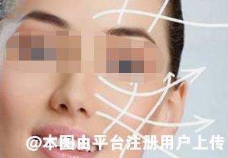 除皱抗衰选择热拉提还是热玛吉？这两者有何区别