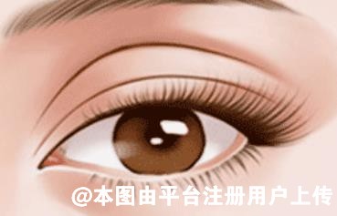 你是眼睑凹陷吗？这里教你如何改善