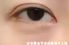 卧蚕和眼袋有什么区别 有什么方法可以丰卧蚕