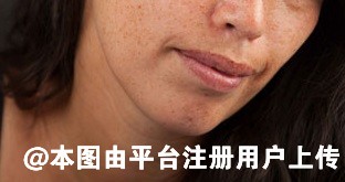 女人进入40岁后想要防止面目长斑 这4个因素要了解清楚-28438