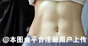 发现大腿抽脂一个月后更粗先别说是反弹先确认饮食习惯