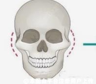 面部整形科普：3种医美方法可以改善自己的颧骨高太阳凹陷