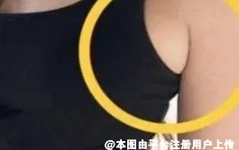 那些觉得长副乳无所谓的女人是因为不知道副乳的危害