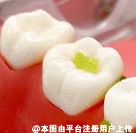 什么是冲牙器 哪些人群适合用冲牙器